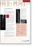 Xray Poster